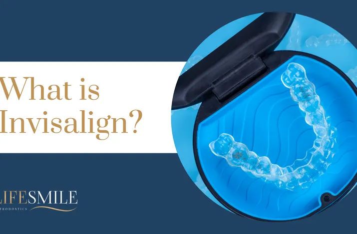What is Invisalign video thumbnail